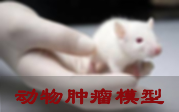 米乐YY易游肿瘤模子建设服务