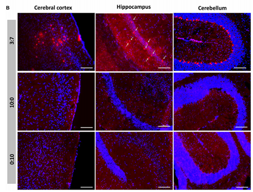 被包裹在含有NT-类脂质的LNP中的Cre重组酶乐成转移。。。。。大脑中的转染神经元呈红色高亮。。。。。