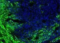联协力量！溶瘤病毒与CAR-T翻开攻克实体瘤难题的新思绪
