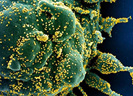 唾液检测新冠抗体新要领来了，，，，，，，，获取效果仅需几小时！