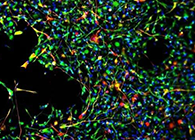 天下首创：药物将干细胞指导至受损部位，，，，，，，提高其愈合能力！
