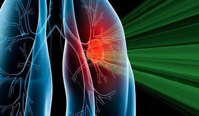 盛世泰科1类立异药物CGT-9475实现中美双报双批 | 米乐YY易游一站式临床宿世物医药研发服务平台助力