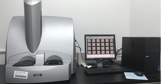 电化学发光免疫法