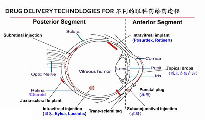 【内附回放+下半场预约】米乐YY易游眼科药物专题钻研会上半场精彩回首