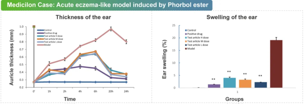 07 佛波酯诱导的急性湿疹样模子.jpg