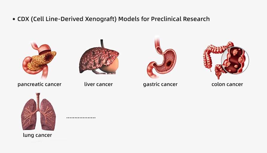 人源肿瘤细胞系异种移植（CDX）模子在临床前研究中的应用